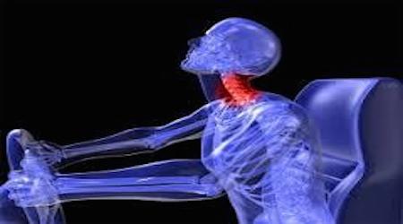 交通事故のケガで最も多い むち打ち症 頚椎捻挫 の症状